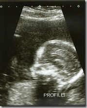 new little one
